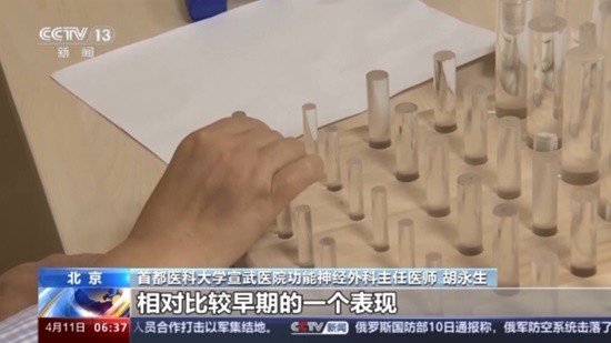 帕金森病也盯上了年轻人：严重社交孤立者患病风险高-第1张图片