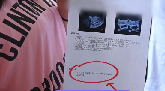 不孕女子喜获3胞胎同卵异卵同出现 医生：第一次见-第1张图片