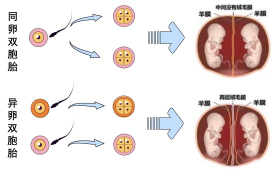 不孕女子喜获3胞胎同卵异卵同出现 医生：第一次见-第2张图片